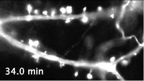 Dynamic actin filaments in dendritic spines