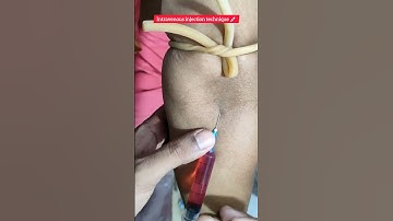 iv injection 💉 | intravenous injection | #viralshorts #trendingshorts #shorts #injection