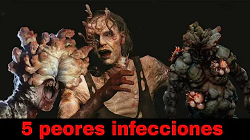 ¿Cuáles son las 4 enfermedades causadas por infecciones fúngicas?