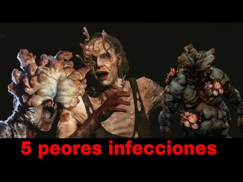 Video: 5 formas de prevenir la propagación de infecciones fúngicas