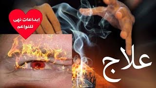 علاج العين ديريها على ضمانتي والله حتى تنوضي من المرض إن شاء الله