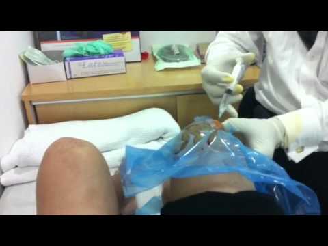 Knee injection of Hyaluronic Acid - YouTube