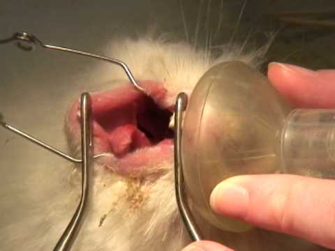 Mandibular and Maxillary Molar Extractions