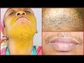 HOW TO GET RID OF UPPER LIP, CHIN AND SIDE HAIR ON THE FACE,  HOMEMADE HAIR REMOVER Khichi Beauty