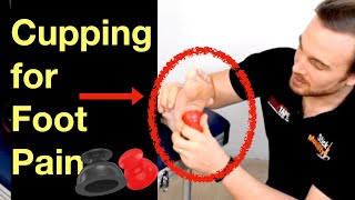 The Best Foot Pain Relief with Cupping (RockPods).