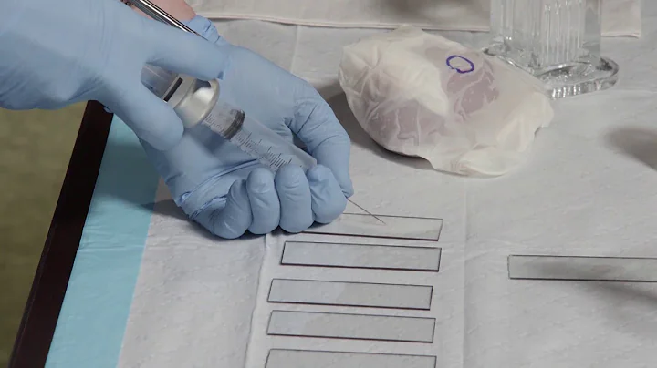 Fine Needle Aspiration Biopsy (FNA) Techniques - Smear Preparation