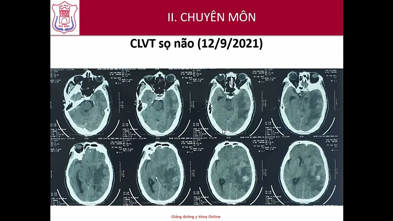 U não | ThS. BS. Nguyễn Việt Đức