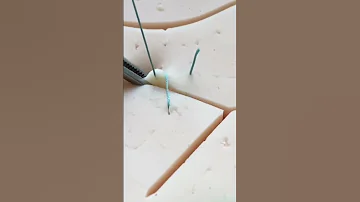 КОГДА МОЖНО ЗАШИТЬ ХИРУРГИЧЕСКУЮ РАНУ?|SCALPEL.MED