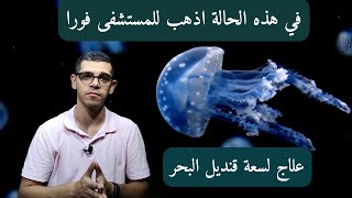 الإسعافات الأولية | علاج لسعة قنديل البحر | في هذه الحالة اذهب للمستشفى فورا🤦‍♂️🤦‍♂️