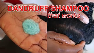 Best Shampoo For Dandruff How To Use Nizoral Anti-Dandruff Shampoo Discoveringnatural