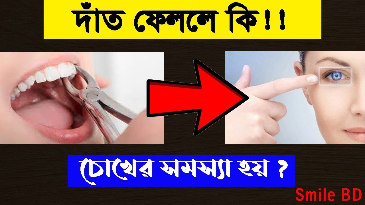 দাঁত তুললে কি চোখের কোন ক্ষতি হয়?tooth extraction problem.dental health tips in bangla by smile