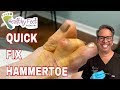 Quick Fix Hammertoe