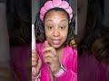 If you’re dealing with hyperpigmentation, skipping sunscreen will undo every skincare product you’re
