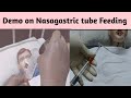 DEMO 5 NasoGastric Tube Feeding/ Ryles Tube Feeding