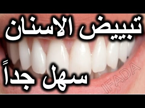 تبييض الاسنان في المنزل في 3 دقائق || كيف تبيض أسنانك الصفراء طبيعيا || 100٪ فعال مرحبا أصدقاء، اليو. 