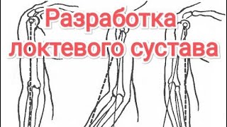 Разработка локтевого сустава