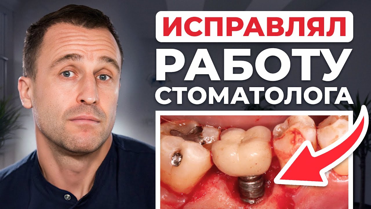 Если ваш имплантолог делает так — БЕГИТЕ ОТ НЕГО! Как НЕЛЬЗЯ ставить зубные импланты?