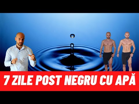 Video: Opțiuni Diferite Pentru Zilele De Post