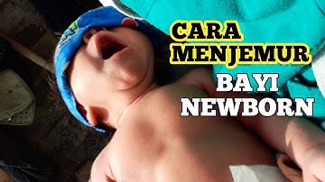 Jemur Bayi Biar Ga Kuning?
