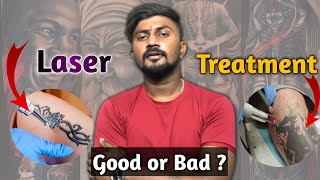 क्या हमें इसका उपयोग करना चाहिए || laser Treatment for Tattoo removal || Good or Bad ??