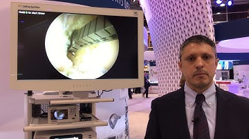 Digital Surgery Solutions: DePuy Synthes PUREVUE Visualization System for Imaging in MIS