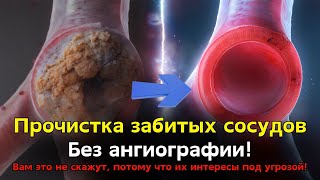 видео: Больше никаких забитых сосудов, инсульта, и ангио не нужно! картинка: Больше никаких забитых сосудов, инсульта, и ангио не нужно!