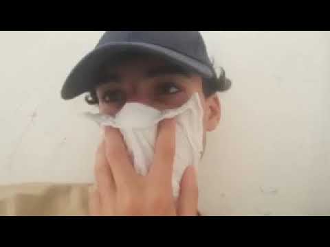 بث مباشر مباراة تشيلسي وبيرنلي اليوم بث مباشر مباريات اليوم يالاشوت كوره لايف ملخص مباريات يوم بث