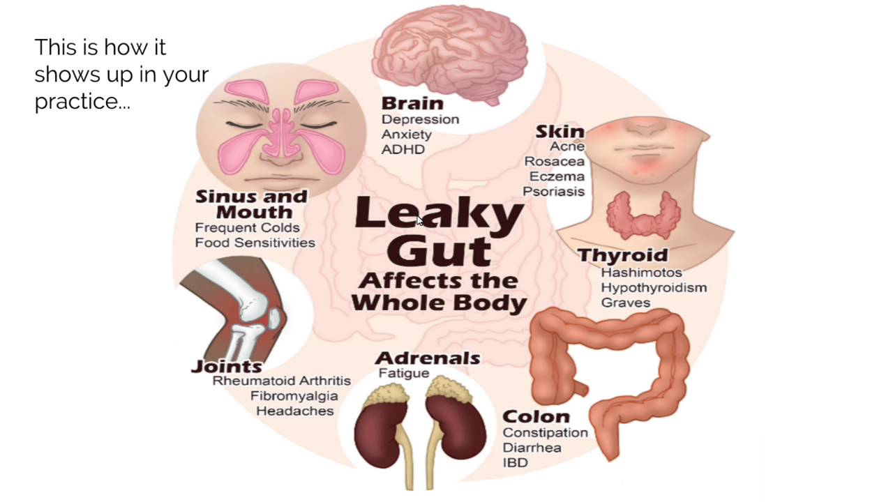 Gut 