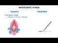 Primary amenorrhea - physiology, pathology, diagnosis, treatment
