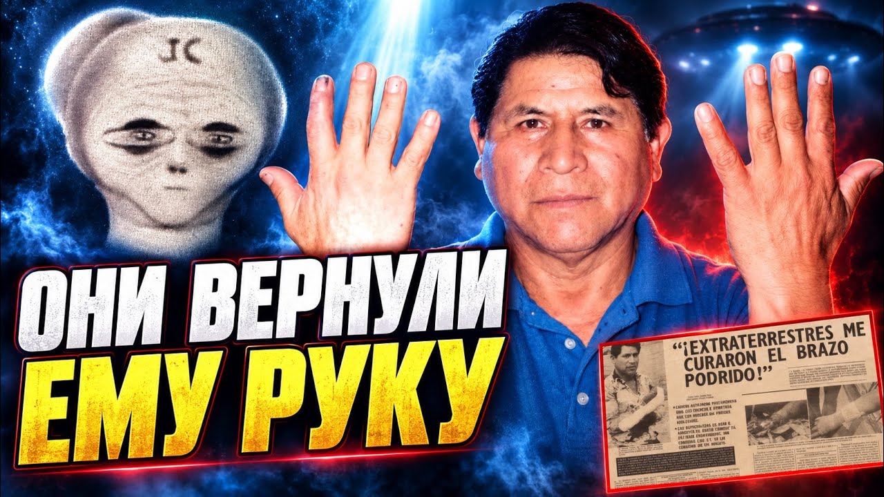 DID ALIENS HEAL HIS ARM? The most incredible healing case — Donato C.