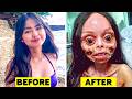 15 Kids Who Had EXTREME Plastic Surgery