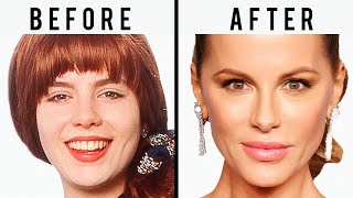 Kate Beckinsale's NEW FACE | Plastic Surgery Analysis