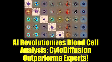 AI Revolutionizes Blood Cell Analysis: CytoDiffusion Outperforms Experts!