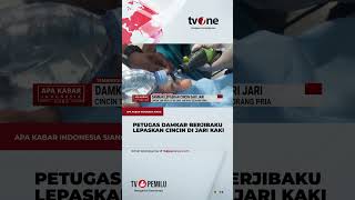 Petugas Damkar Lepaskan Cincin Di Jari Pria Yang Membengkak  Tvone