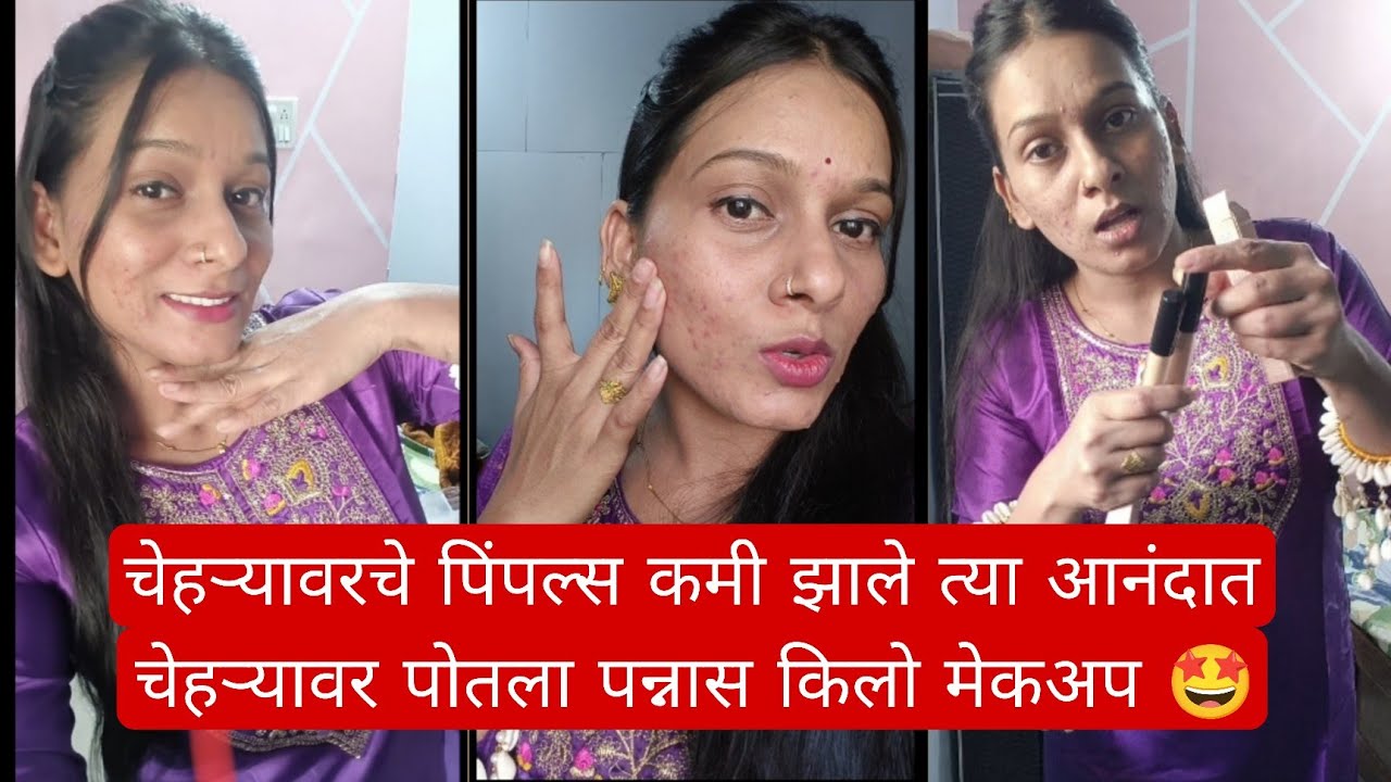 चेहऱ्याचे पिंपल्स कमी झाले तर आनंदा चेहऱ्यावर पोतला पन्नास किलो मेकअप 🤩#dailyvlog 