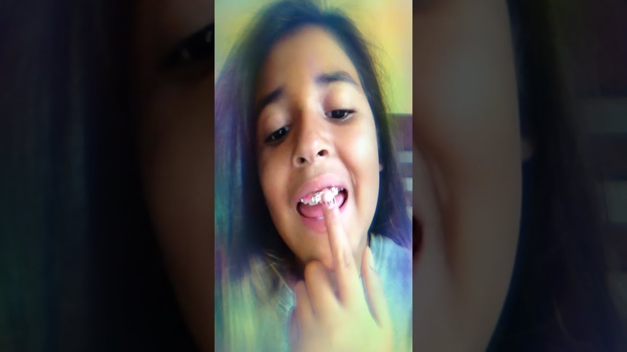 How to make fake braces YouTube