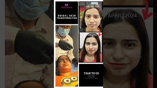 Pre-bridal Skincare || Reforms Clinic