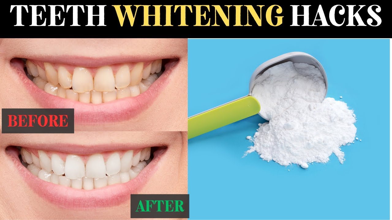 8 Best Ways To Naturally Whiten Yellow Teeth At Home/Simple Hacks YouTube