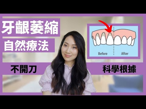 【Eng subs】牙齦萎縮 Gum Recession Natural Remedies 這些自然療法真的有科學根據！油拔法怎麼進行？｜Dr. Grace