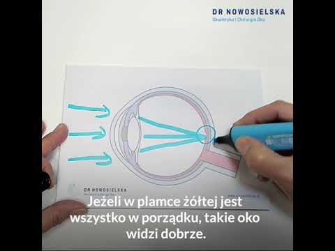 Wideo: Zaćma - Leczenie Zaćmy środkami I Metodami Ludowymi - Leczenie Zaćmy Miodem