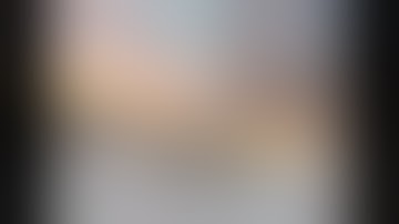 Robotic left upper lobectomy - incomplete fissure, narrated