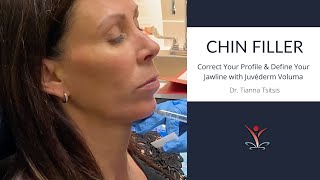 Contour Your Chin & Jawline with Filler Contour Your Jawline With Filler