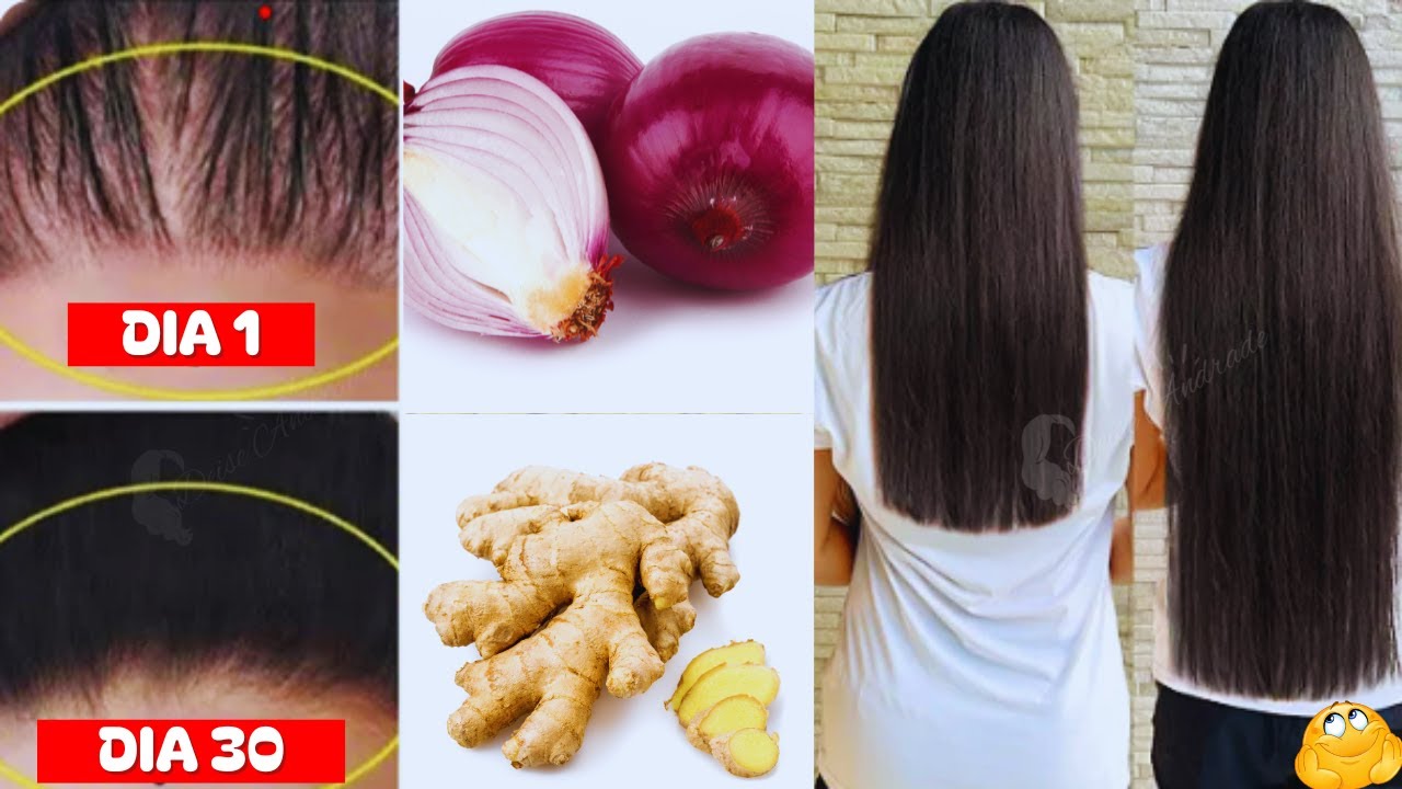 COMO FAZER O CABELO CRESCER RÁPIDO E PARAR A QUEDA COM GENGIBRE E CEBOLA ROXA #crescimentocapilar