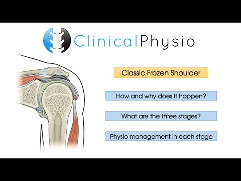 Frozen Shoulder Exercises V2 - Adhesive Capsulitis - Calcific Tendonitis - Shoulder Stiffness. 