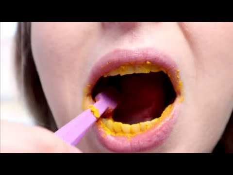 Video: Kako zaščititi zdrobljen zob (s slikami)