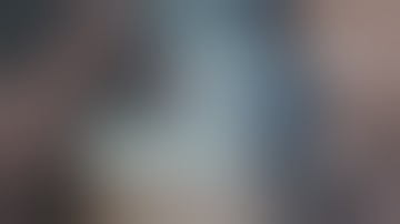 Dandruff Shampoo and Scratching, Itchy Dry Scalp, Huge Flake - Psoriasis #131