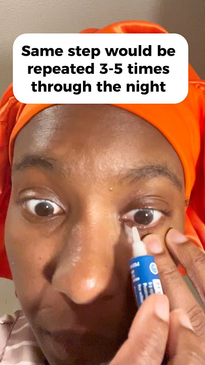 #mgd #blepharitis #chronicdryeyes #dryeyes