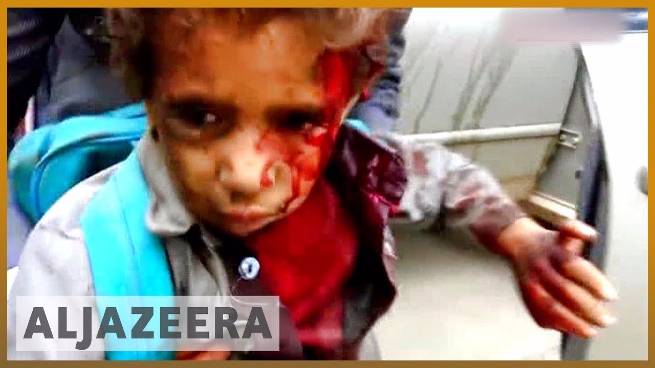 اليمن: مقتل عشرات المدنيين في هجوم على حافلة مدرسية | الجزيرة الإنجليزية