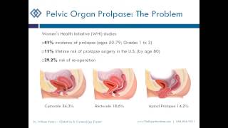 Pelvic Mesh and Morcellator Use In Gynecological Surgery Webinar