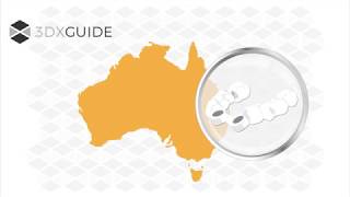 3DX-Guide - For Better Guided Surgery: How it works